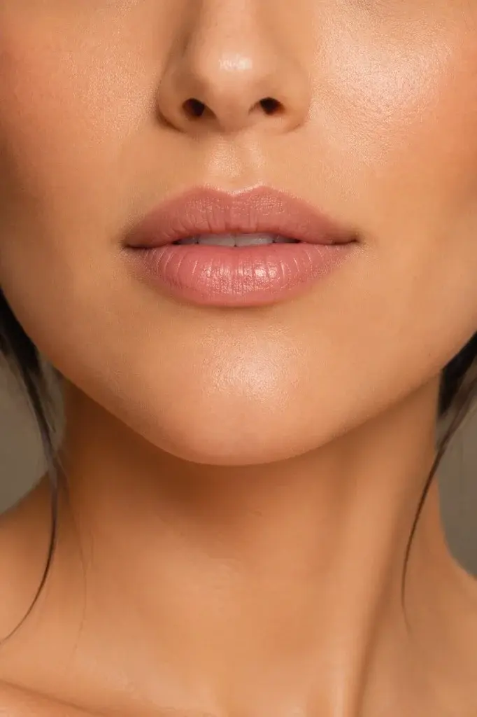 Labio superior definido — lip lift en Bogotá