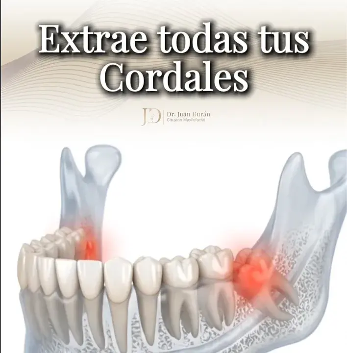 Extrae todas tus cordales — Dr. Juan Durán, cirujano maxilofacial