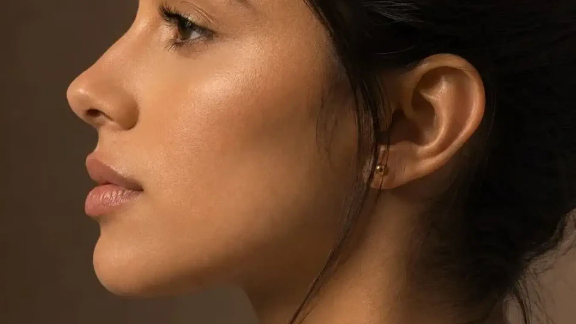 Perfil facial armónico — cirugía del maxilar superior