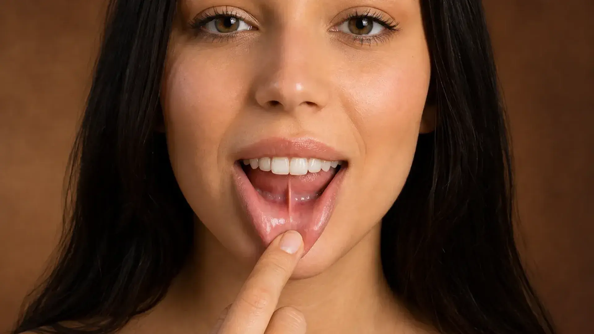 Exposición del frenillo labial inferior — frenillectomía